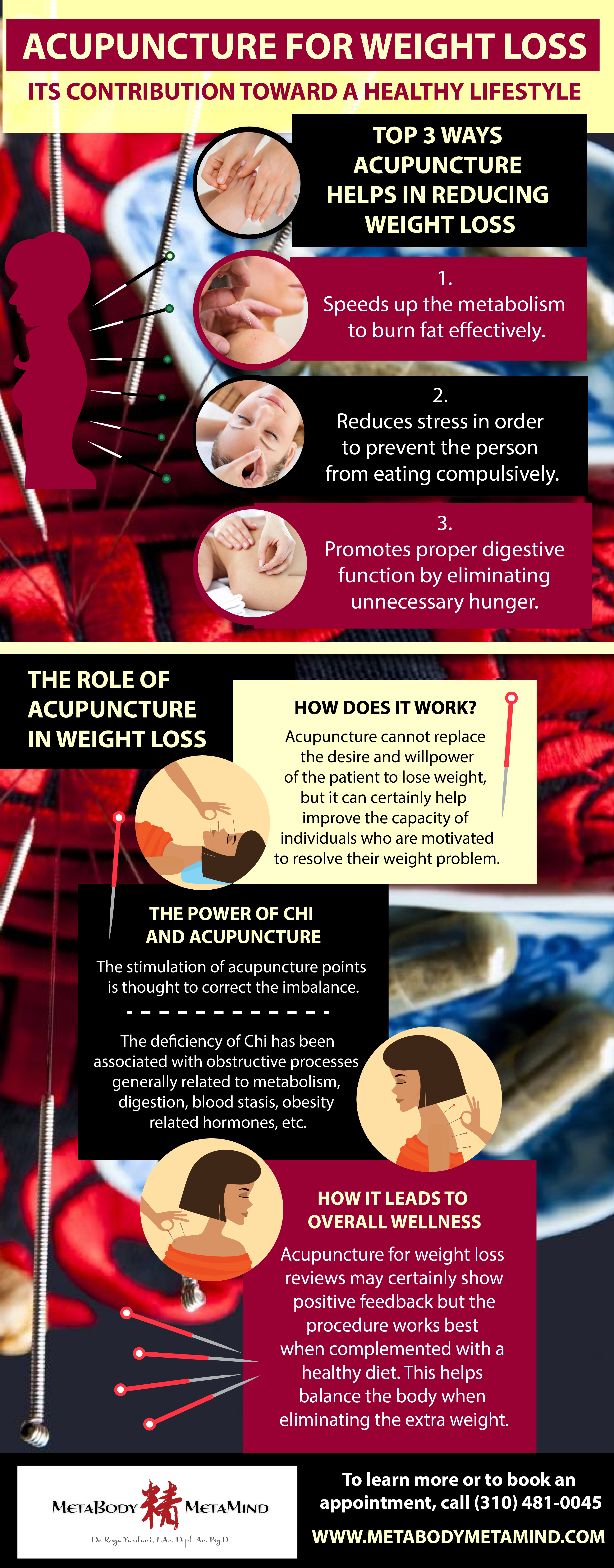 Top 3 Ways Acupuncture Helps In Reducing Weight Loss