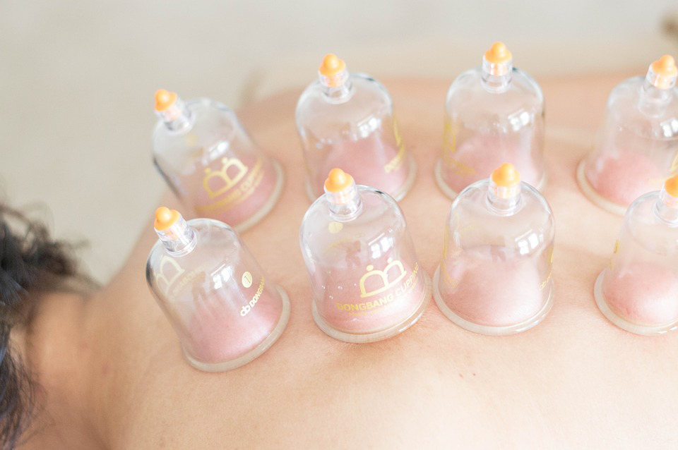 4 Proven Wellness Benefits of Cupping Therapy